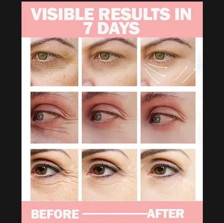 Under Eye Serum Dark Circle Removal 30ML Glass Bottle