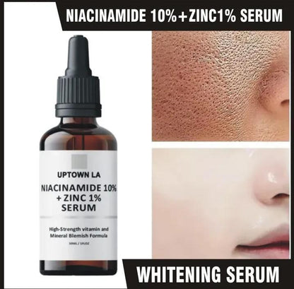 Whitening Serum 10% Niacinamide 1% Zinc 30ml