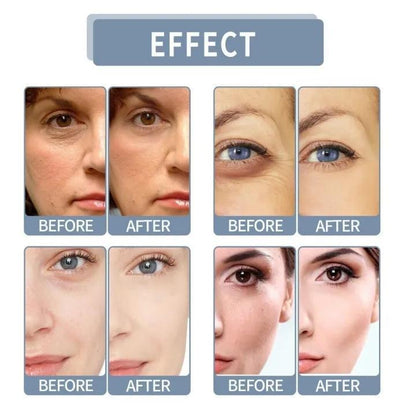 Whitening Serum 10% Niacinamide 1% Zinc 30ml