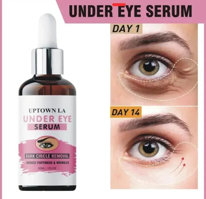 Under Eye Serum Dark Circle Removal 30ML Glass Bottle